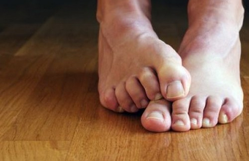 θεραπείες για την ονυχομυκητίαση