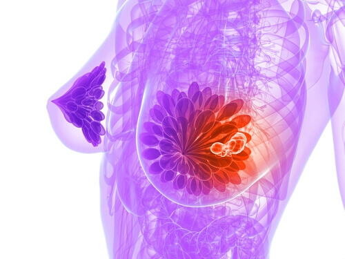 ωφέλειες των κουκουτσιών του σταφυλιού- καρκίνος του μαστου