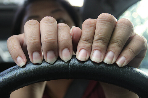 Γιατί ξεφλουδίζονται τα νύχια - Φθαρμένα γυναικεία νύχια