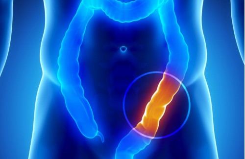 έγκαιρη ανίχνευση του καρκίνου