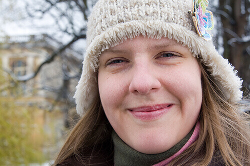 Πρόωρες ρυτίδες στο πρόσωπο - Γυναίκα χαμογελά