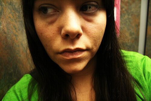 Πρόωρες ρυτίδες στο πρόσωπο - Γυναίκα με ρυτίδες στο πρόσωπο