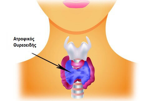 Πρωινή κούραση: ορμονικά προβλήματα