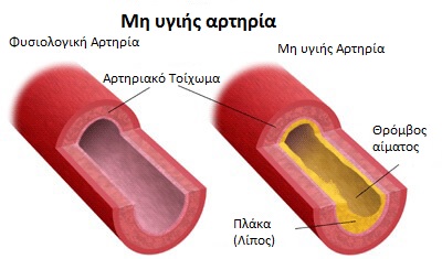 καρδιακές παθήσεις