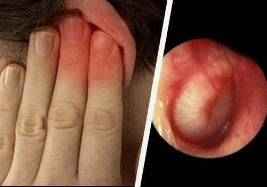 Πώς να ξεβουλώσετε τα αυτιά σας - Αυτί με μόλυνση