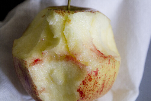 Τρόποι αντιμετώπισης της ουλίτιδας - Αίμα από ούλα σε δαγκωμένο μήλο