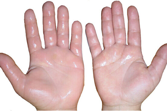 Ανθρώπινο σώμα - Ανθρώπινα χέρια