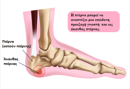 πόνο στις φτέρνες - άκανθα