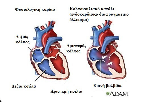 7 συμπτώματα του καρδιακού φυσήματος
