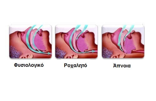 Στοιχεία για το ροχαλητό