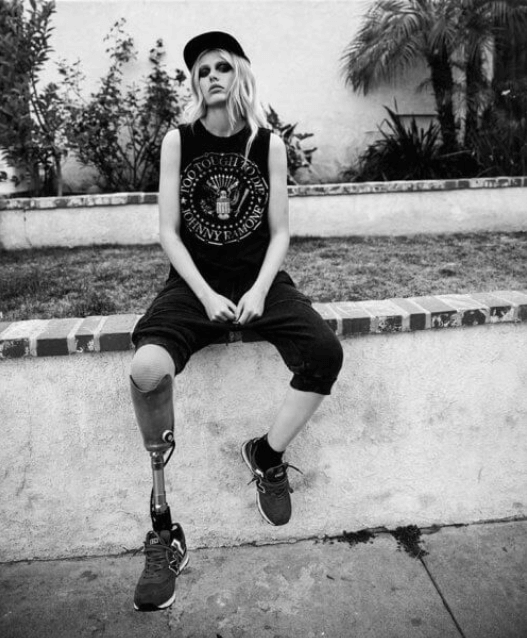 Το πόδι ενός μοντέλου ακρωτηριάστηκε λόγω του ταμπόν - Ασπρόμαυρη φωτογράφιση της Lauren Wasser