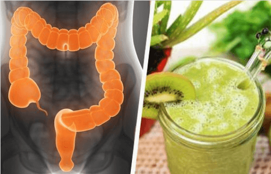 Μη υγιές παχύ έντερο - Παχύ έντερο και χυμός ακτινίδιο