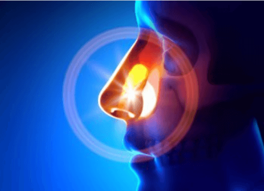 μύτη που πονά