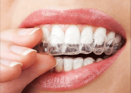 Τρίξιμο των δοντιών: 4 φυσικές θεραπείες