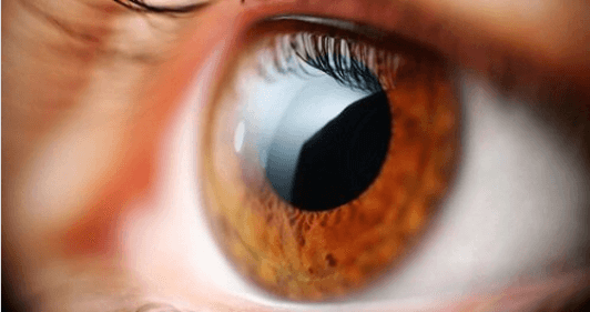 Γιατί η όρασή σας είναι θολή: Αιτίες και αντιμετώπιση