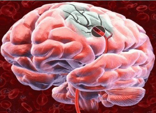 5 τρόποι για να αυξήσετε τη ροή του αίματος στον εγκέφαλο