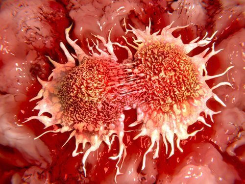 Λεμόνι για την καταπολέμηση όγκων - Καρκινικά κύτταρα