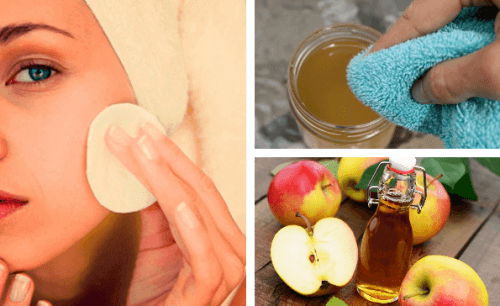 Καθαρισμός προσώπου με μηλόξυδο: Ποιες οι ωφέλειές του;