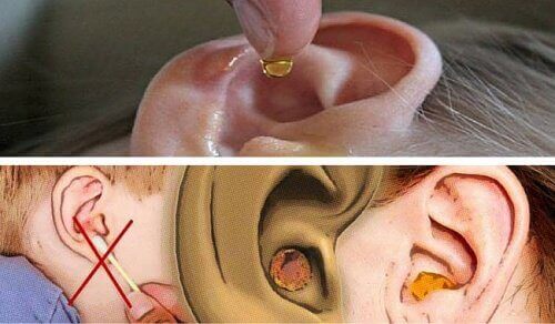 Αφαιρέστε φυσικά την περιττή κυψελίδα από τα αυτιά