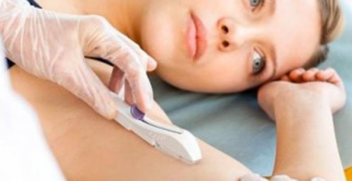 Υποδόρια αντισυλληπτικά εμφυτεύματα - Γιατρός τοποθετεί εμφύτευμα σε γυναίκα
