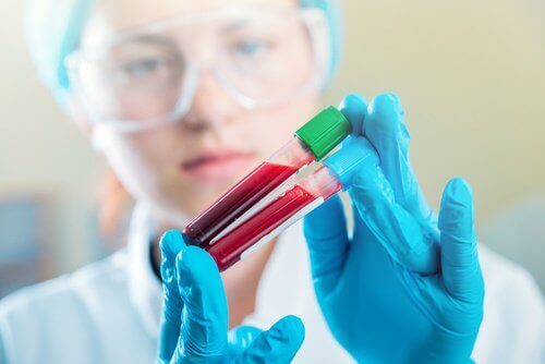 Μικροβιολόγος με φιαλίδια αίματος, εξελίξεις της οστεοαρθρίτιδας