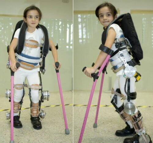 Παραπληγικά παιδιά - Κοριτσάκι με εξωσκελετό