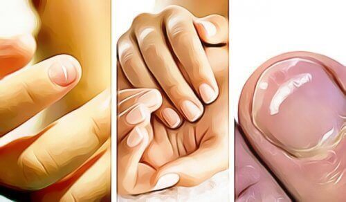 Σημάδια στα νύχια και τι σημαίνουν για την υγεία σας