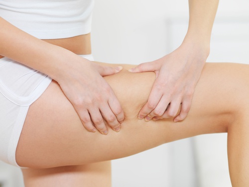 Χυμός λιναρόσπορου - Γυναικείο πόδι με κυτταρίτιδα