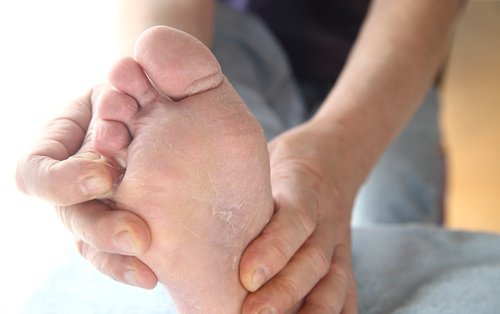 6 οφέλη του να μουλιάζετε τα πόδια σας στο ξύδι, σκληρά πόδια