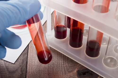Ο καρκίνος μπορεί τώρα να εντοπιστεί με εξετάσεις αίματος