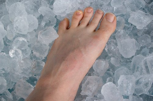 πόδι σε πάγο Ανακούφιση από την τενοντίτιδα