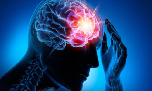 4 εγκεφαλοαγγειακές ασθένειες που συναντώνται συχνά