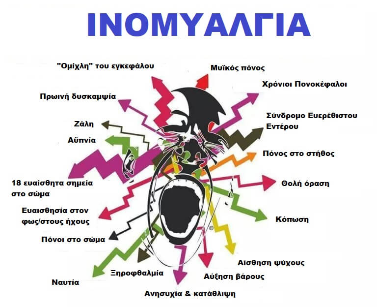 Αντιμετώπιση της ινομυαλγίας