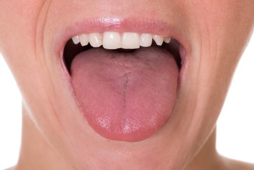 Τα πρώτα 5 συμπτώματα του καρκίνου της γλώσσας
