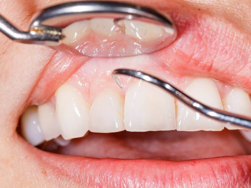 Πράσινο μήλο - Γιατρός ελέγχει τα δόντια ασθενούς