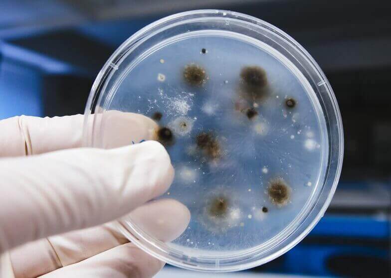 μύκητες σε εργαστηριακό δείγμα-  κολπικές λοιμώξεις