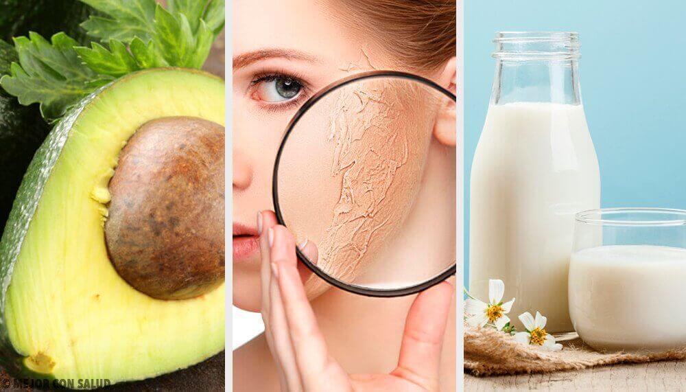 γυναίκα με ξηρό δέρμα στο πρόσωπο