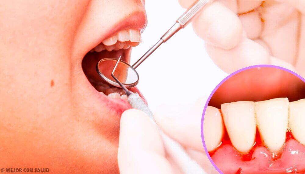Οδοντιατρικός έλεγχος ούλων- λοιμώξεις στα ούλα