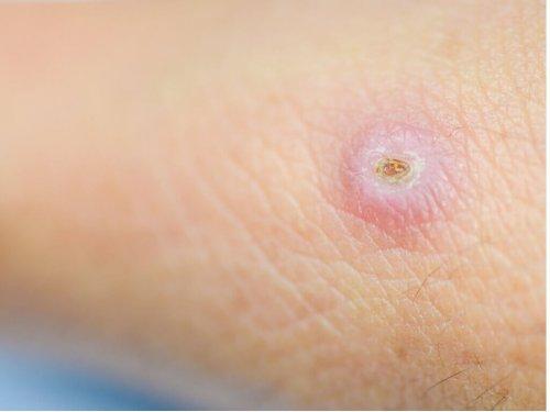 Καλόγερος με κίτρινο κεφάλι