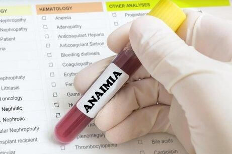 Γιατρός κρατά φιαλίδιο με αίμα