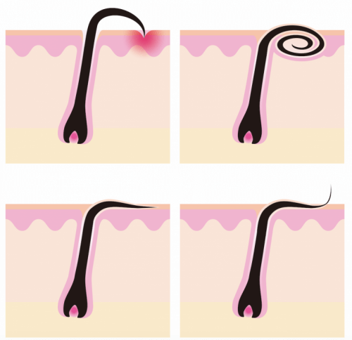 Απεικόνιση ανάπτυξης της τρίχας