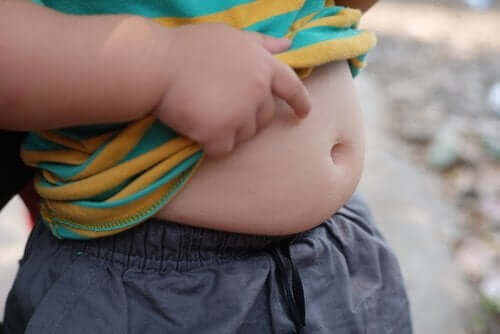 Παιδική παχυσαρκία: Ένα μεγάλο πρόβλημα