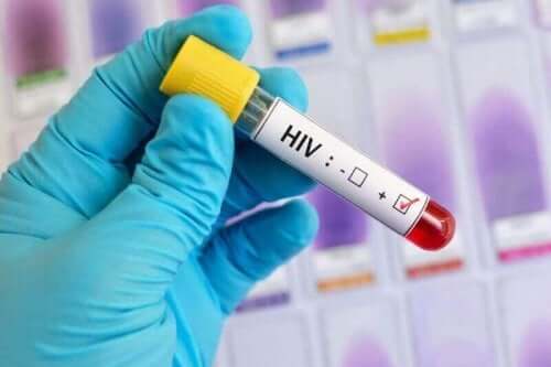 Δείγμα αίματος για HIV