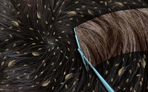 πώς να ξεφορτωθείτε τις κόνιδες