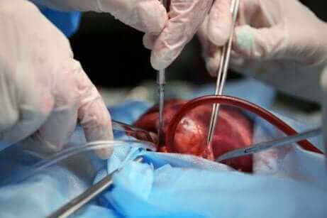 Γιατροί κάνουν επέμβαση σε καρδιά