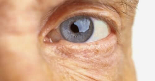 Μάτι ηλικιωμένου ατόμου