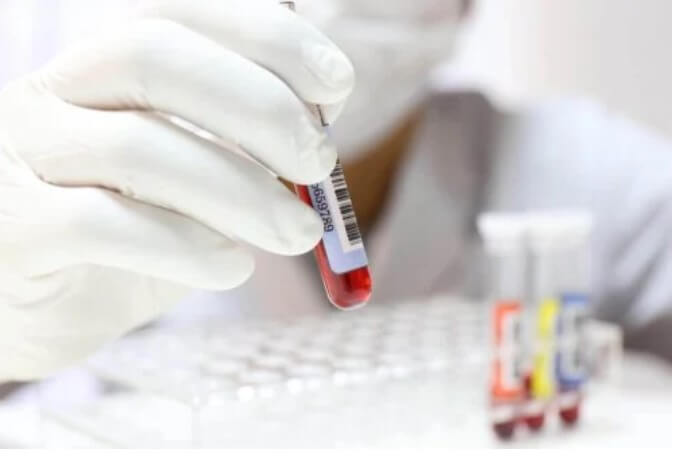 Αίμα σε δοχείο