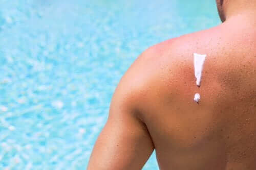 Οι βλαβερές επιπτώσεις του ήλιου στο δέρμα σας