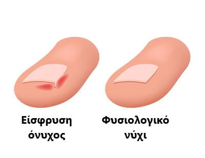 Σύγκριση δαχτύλων