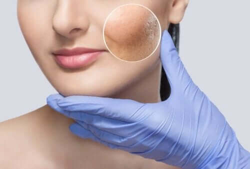 Όσα πρέπει να γνωρίζετε σχετικά με το Soft lift